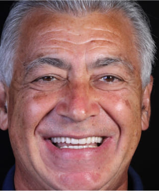 Sorrisos